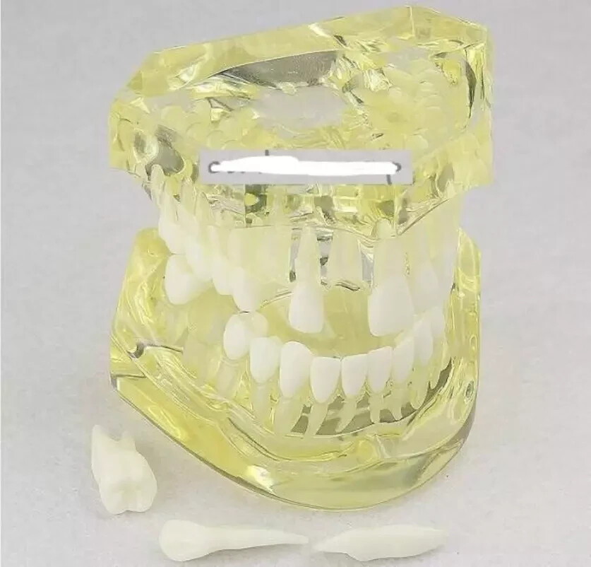 Dental Demonstration Removable Restoration Typodont Study Teeth Yellow 7006-2