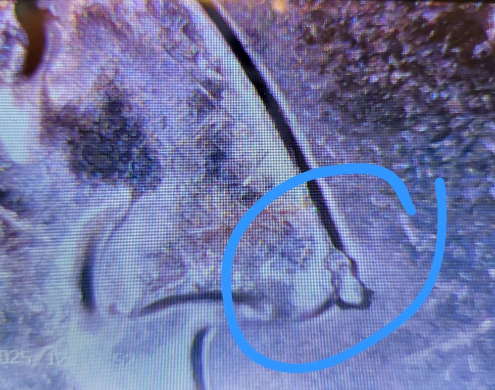 2023 P Edith Kanakaole Quarter With Errors