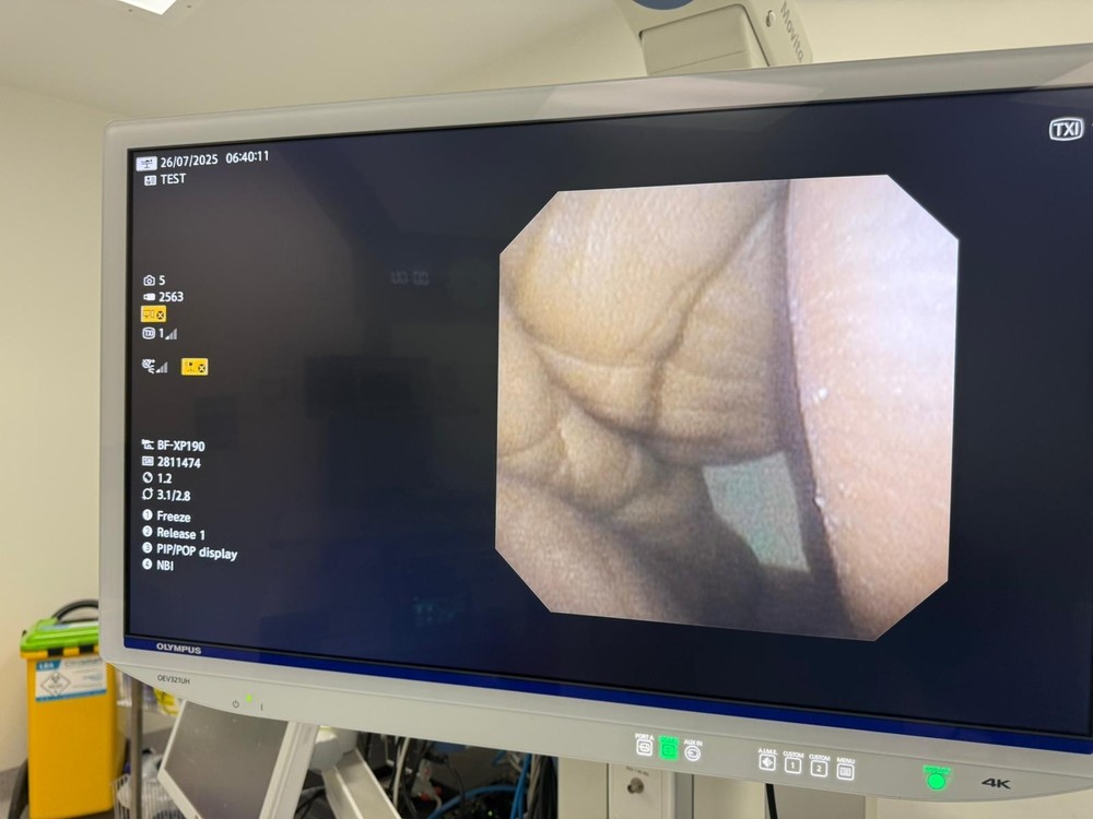 BF-XP190 Bronchoscope Overhauled