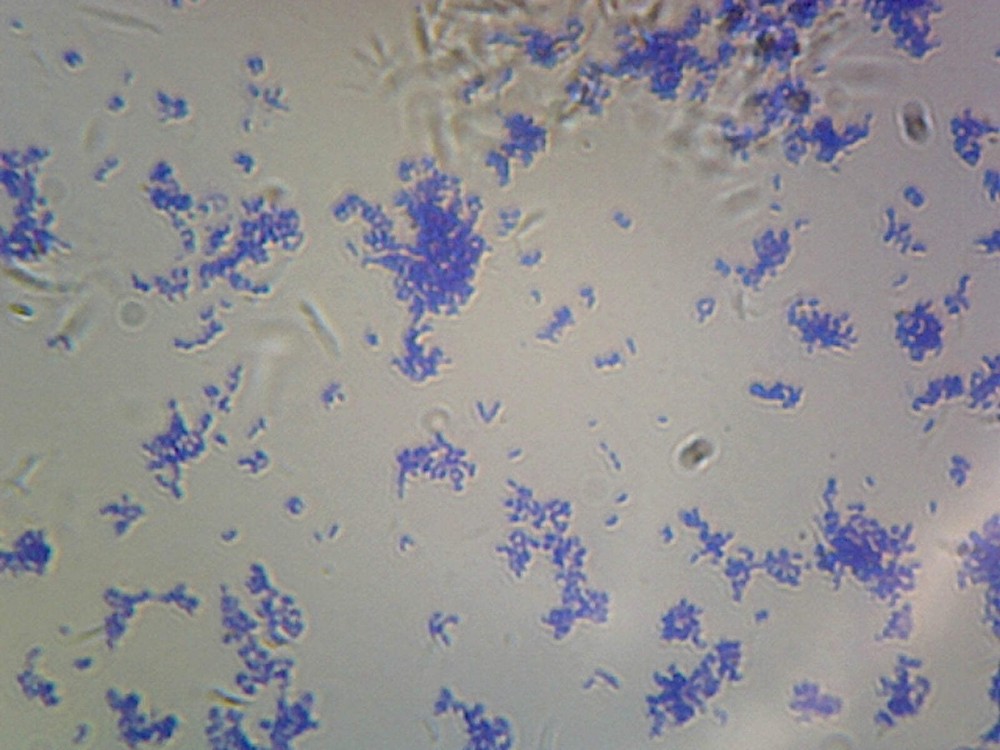 Corynebacterium Diphtheriae, Rod-Shaped; Smear; Gram-Positive