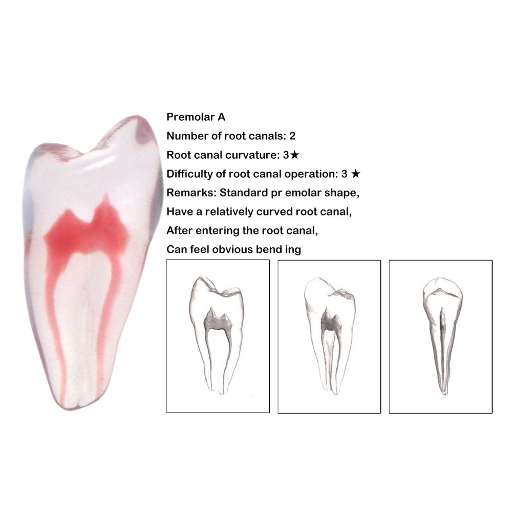 Dental Resin Endo Root Canal Teeth Model Practice Block RCT Pulp Cavity Study