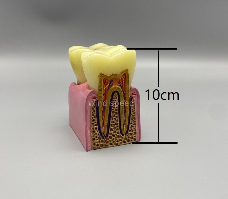 Dental Typodont Teeth Study Teach Model Implant Endo Caries Demonstration