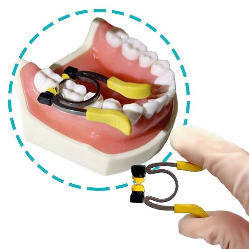 Dental Matrix Bands Sectional Matrix System Paediatric Matrices Clamp Ring+Wedge