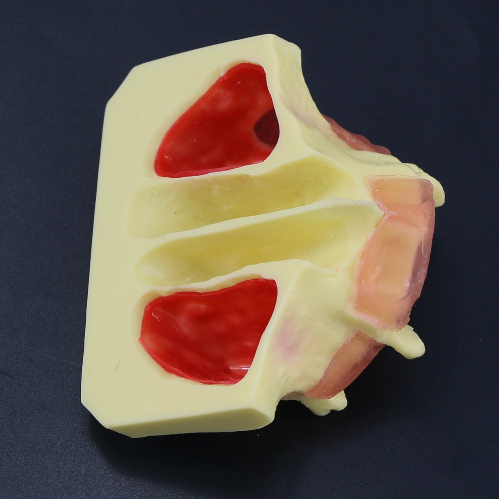 Dental Typodont Teeth Model Sinus Lift Practice Study Teach Demo Model 2012 2013