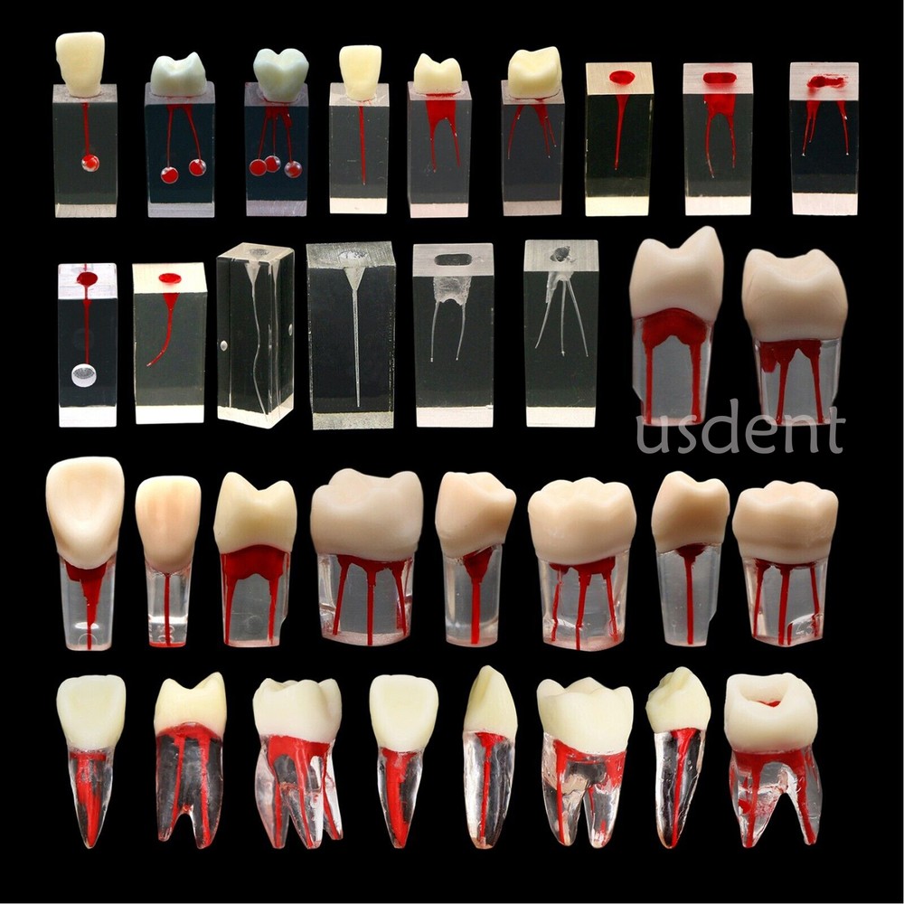 10Pcs Dental RCT Endo Root Canal Teeth Model Practice BlockPulp Cavity Study
