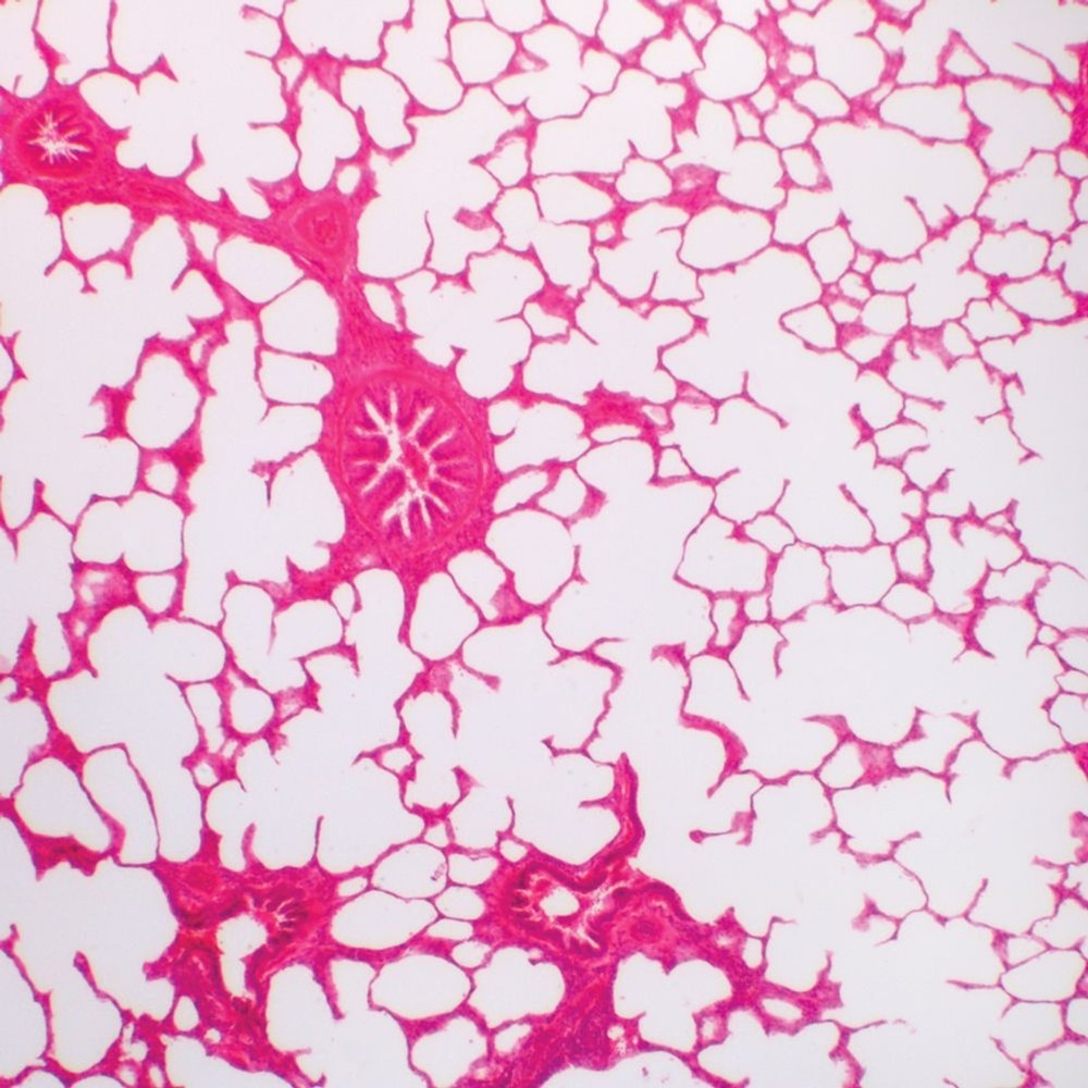 ABGIL Human Pathology Microscopic Slides.