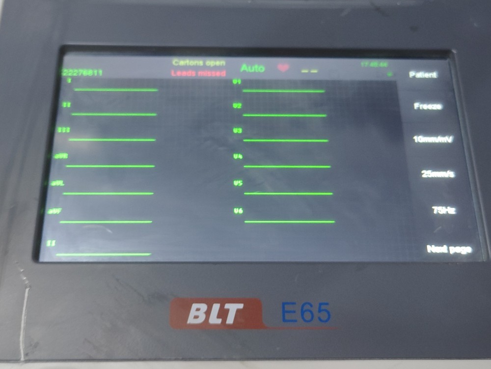electrocardiograph Digital Biolight E65 ECG Machine 12 Channel ECG Machine