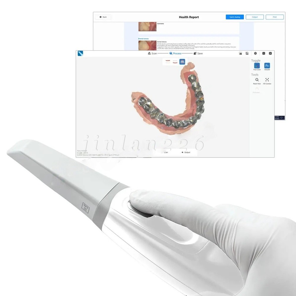 DENTAL INTRA ORAL SCANNER FDA