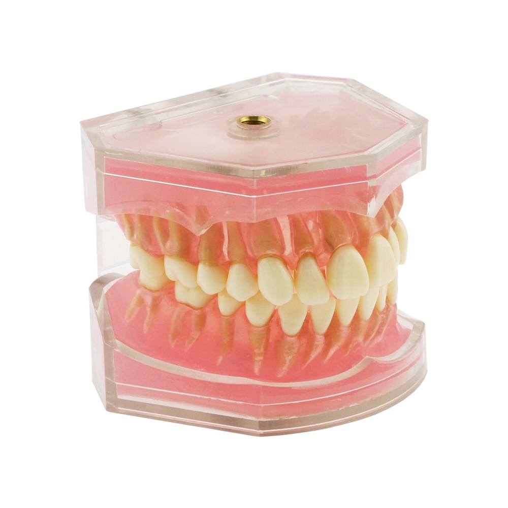 Dental Typodont Practice Model 28Pcs Removable Teeth Model Soft Gum with Cheek