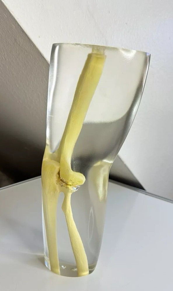 RSD Phantoms Natural Transparent Mannequin Elbow (Testing & Calibration)