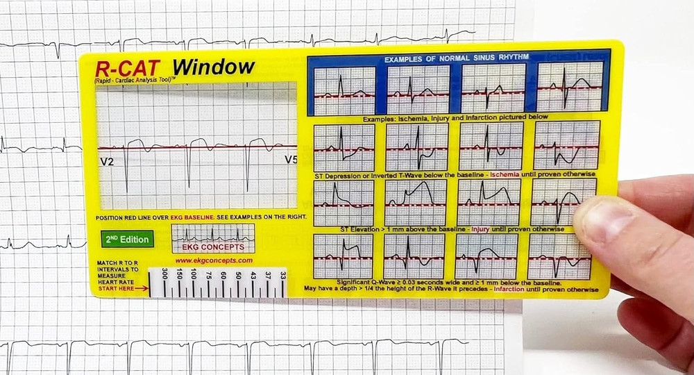EKG Window 2Nd Edition