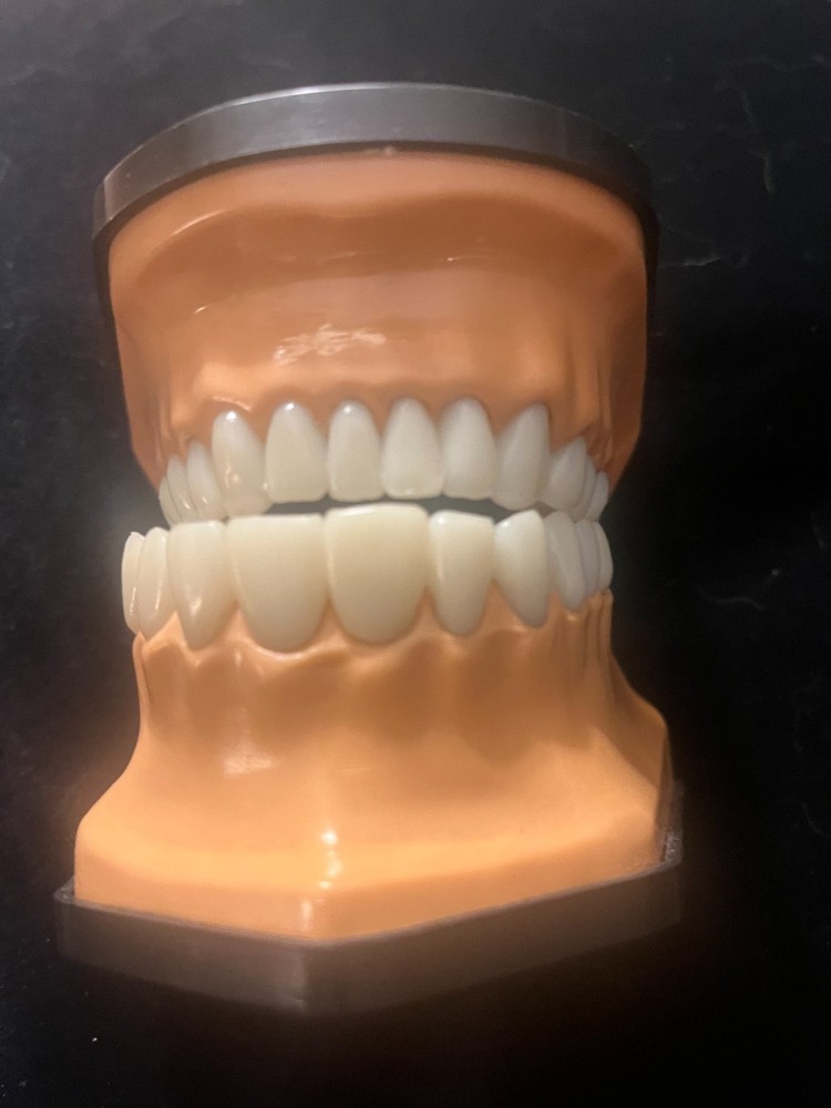 Flossing And Brushing Teaching Dental Typodont Model LFA # 2631 No Toothbrush.