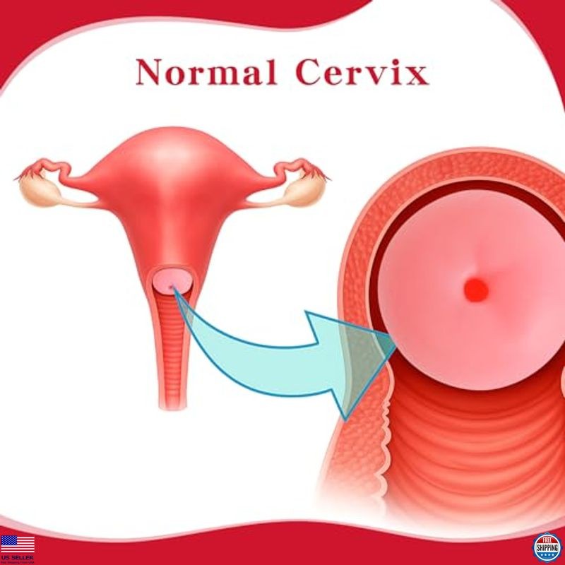 SimCoach Cervical Pathology Model Set - 6 Realistic Cervix Replicas for Training