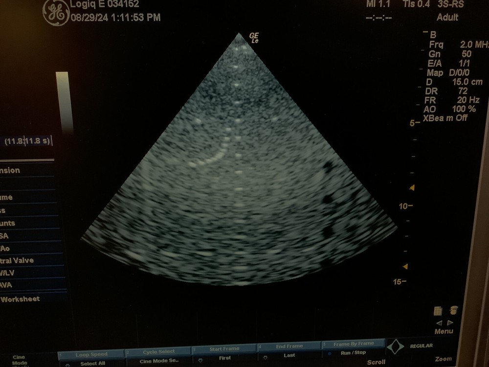 2005 GE 3S-RS Phased Array Ultrasound Probe (White Connector)