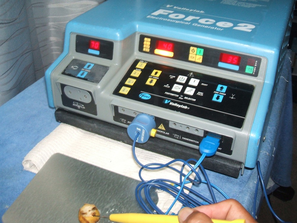 Valleylab Force 2 ESU, Pt. Ready, Nice/Clean/In Great Working Condition, Cert'd
