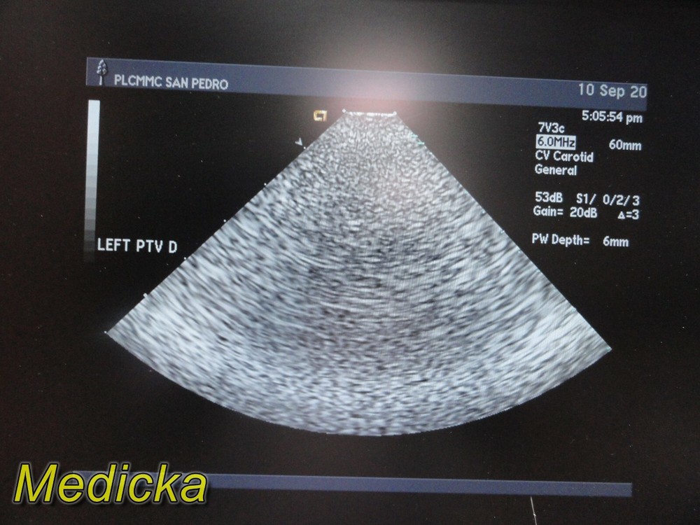 Acuson 7V3C Phased Array Ultrasound Probe / Transducer ~ 22610