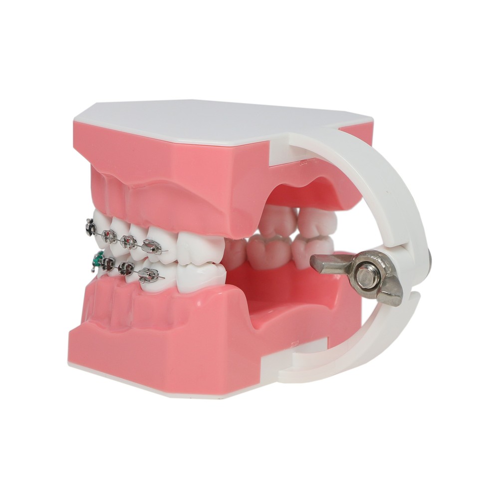 US Dental Typodont Demonstration Teeth Model with Braces For Patient Teach Study