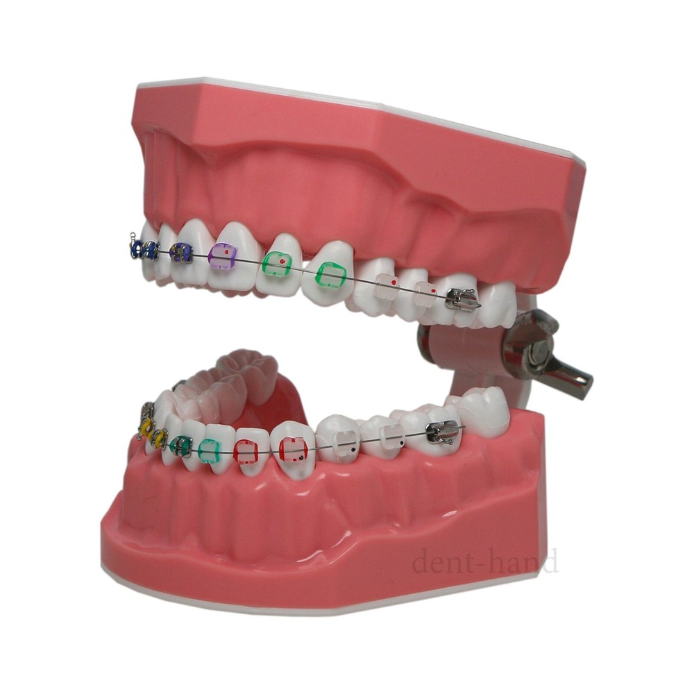 Dental Typodont Teeth Model 1:1 Teach Study Half Metal Ceramic Brackets Tubes