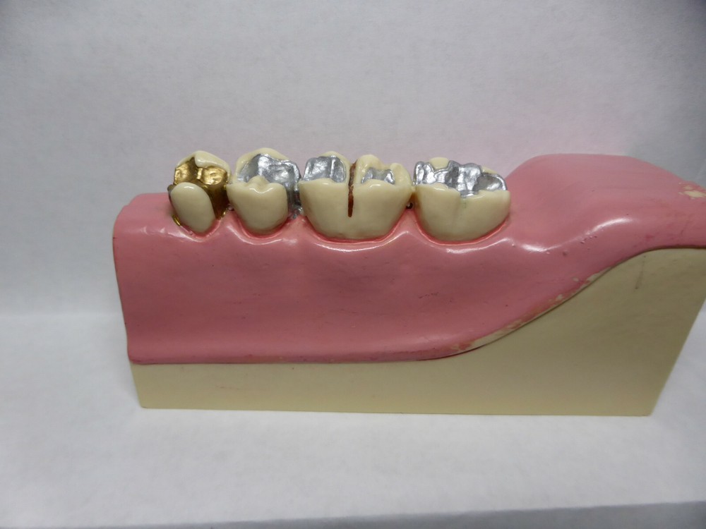 Typodont, Common Dental Pathologies Model, Patient instruction, x- section