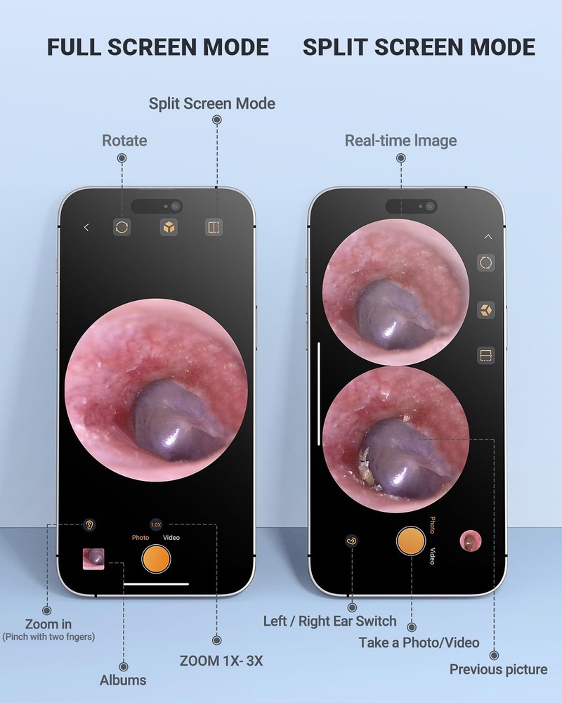 AnyScope Digital Otoscope Compatible with iPhone and Android Devices, HD Ear ...