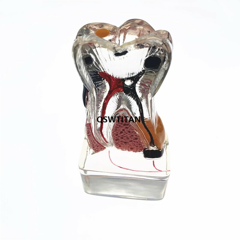 Teeth Model 4 times tooth pathology model Periodontal Teaching Study model