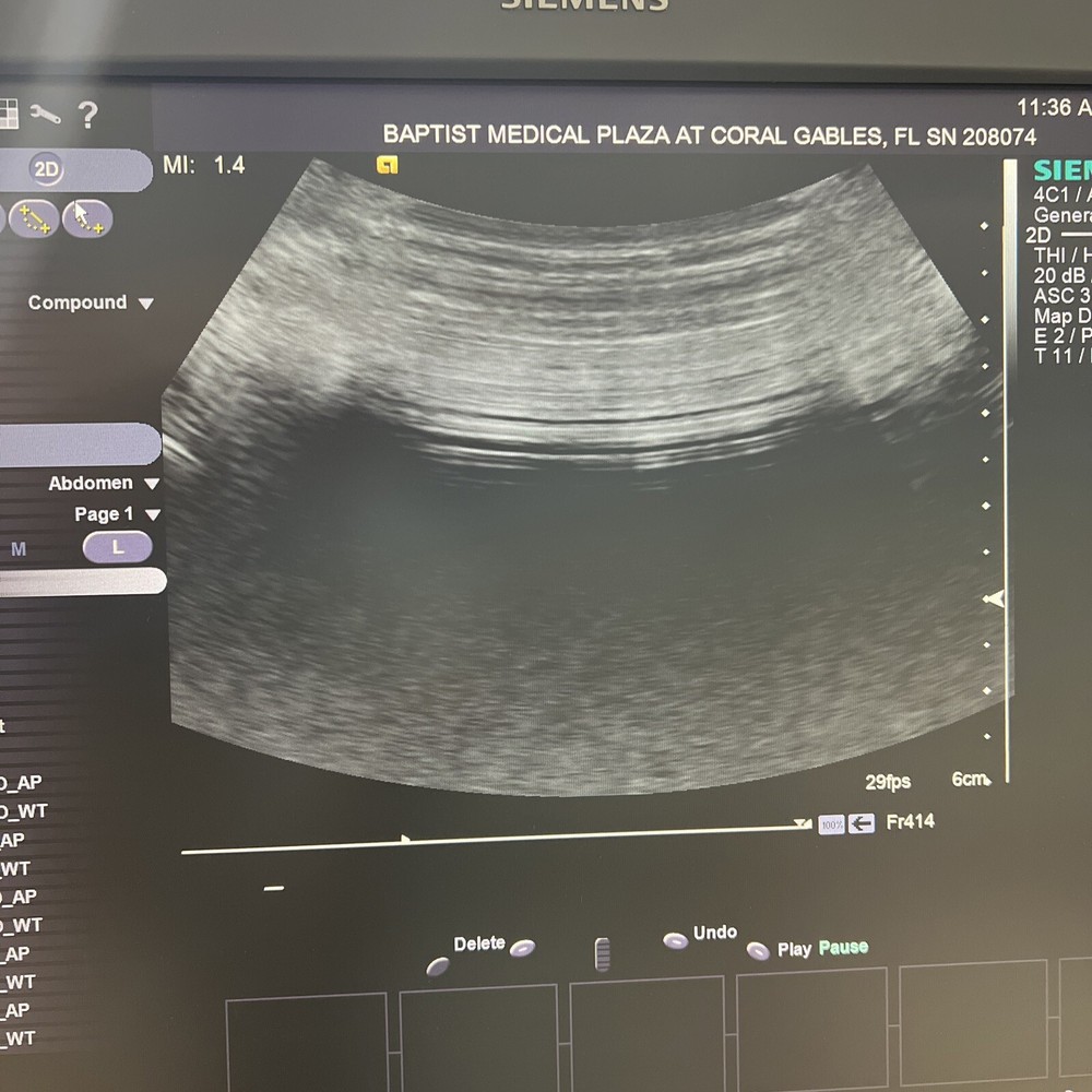 Acuson 4C1 Ultrasound Probe/ Transducer
