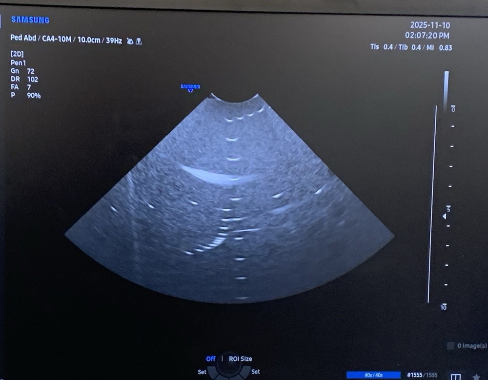Samsung CA4-10M Micro Curved Array Ultrasound Probe, YOM: 2023