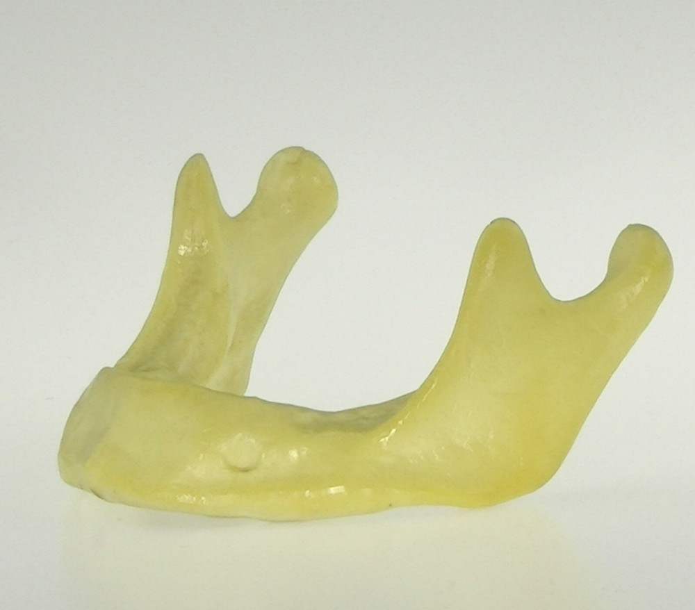 Dental Mandible Jaw Model for Basic Drilling Implant Insertion Practice 10PCS