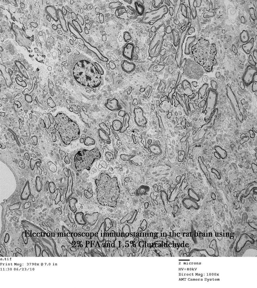 Paraformaldehyde, 4% in PBS - 500 mL  (TissuePro)