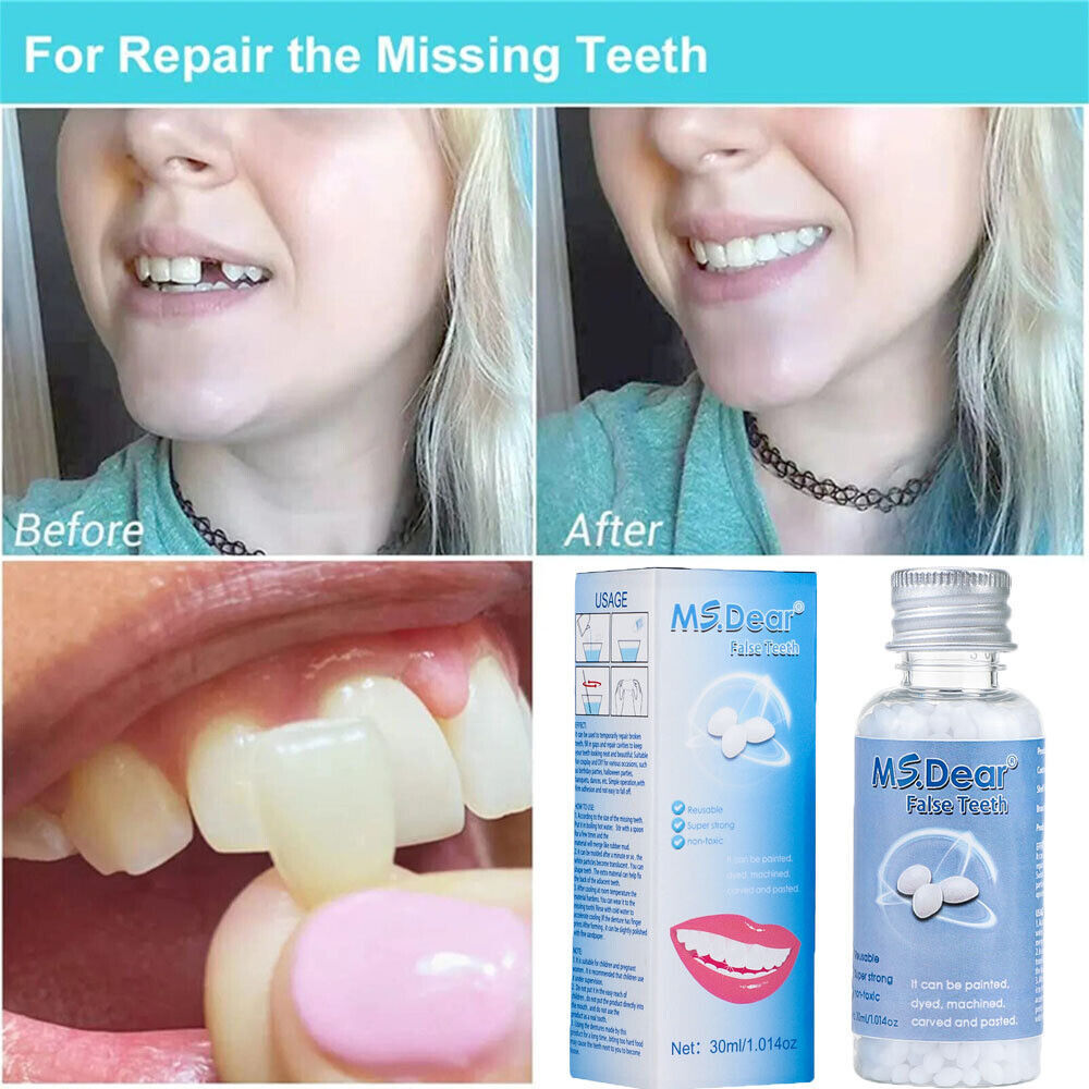 2× Resin False Teeth Solid Glue Temporary Tooth Gap Filler Tooth Repair Moldable