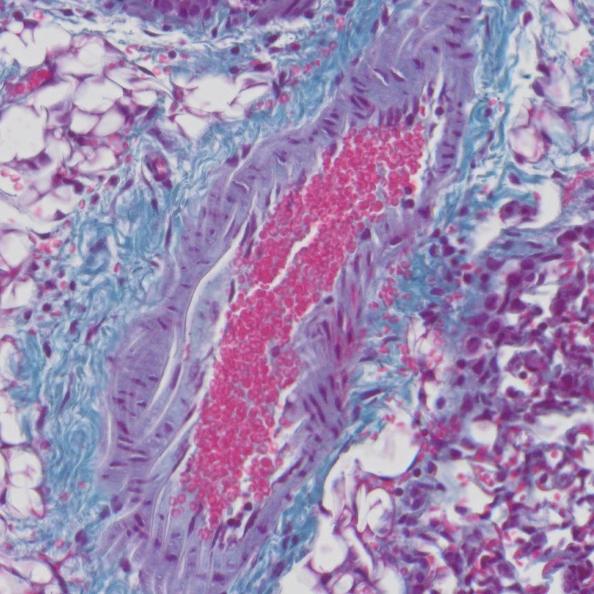 VitroView™ Modified Gomori’s Trichrome Stain Kit (Cat#VB-3014)