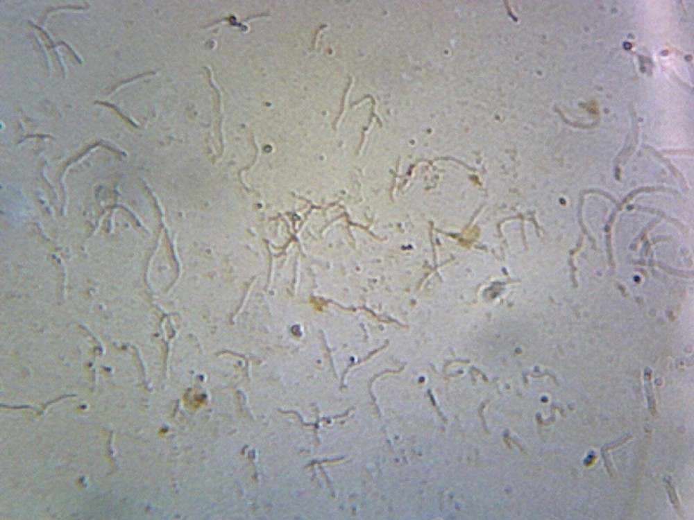 Leptospira (Spirochetes); Smear