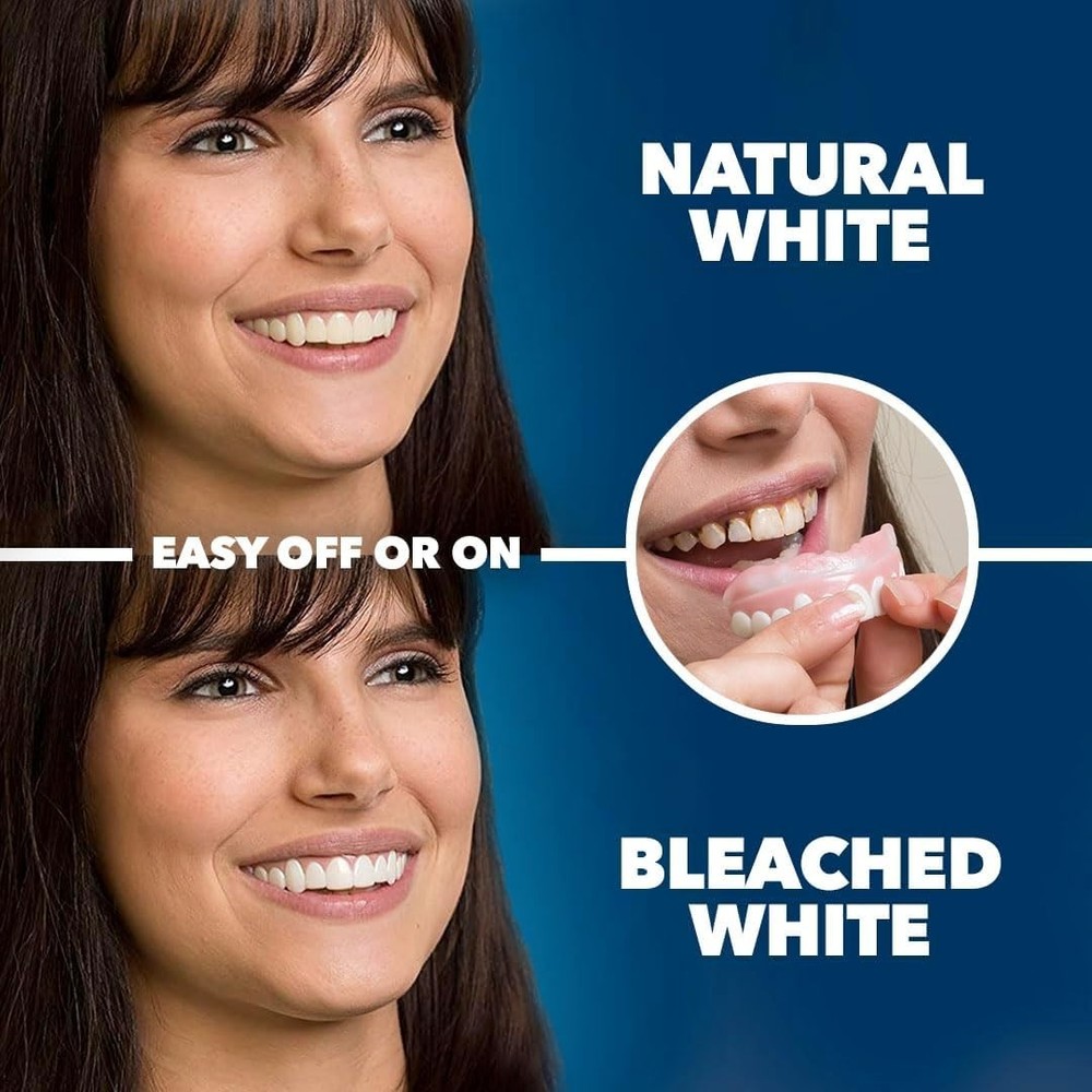 Discreet DIY Veneers - Natural White-