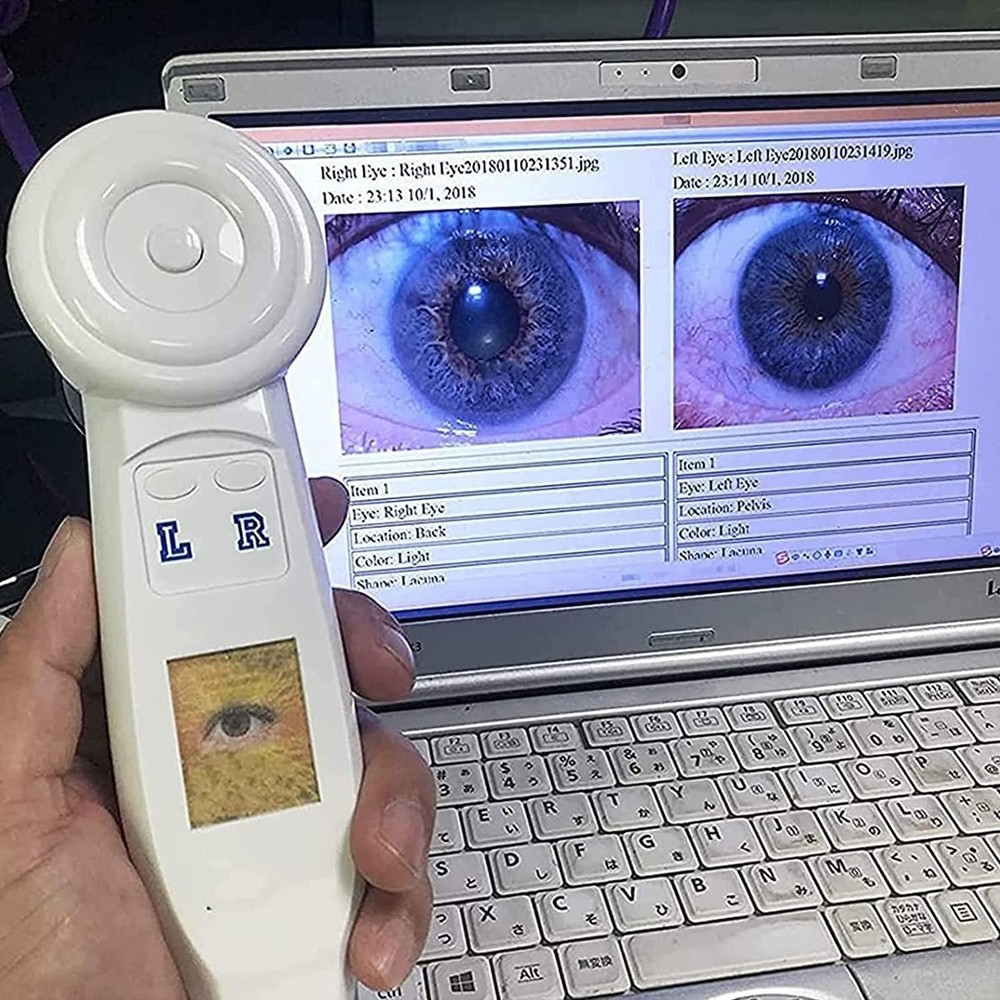 5.0 MP USB Iris Analyzer Iridology Camera with Pro Iris Software Analysis Camera