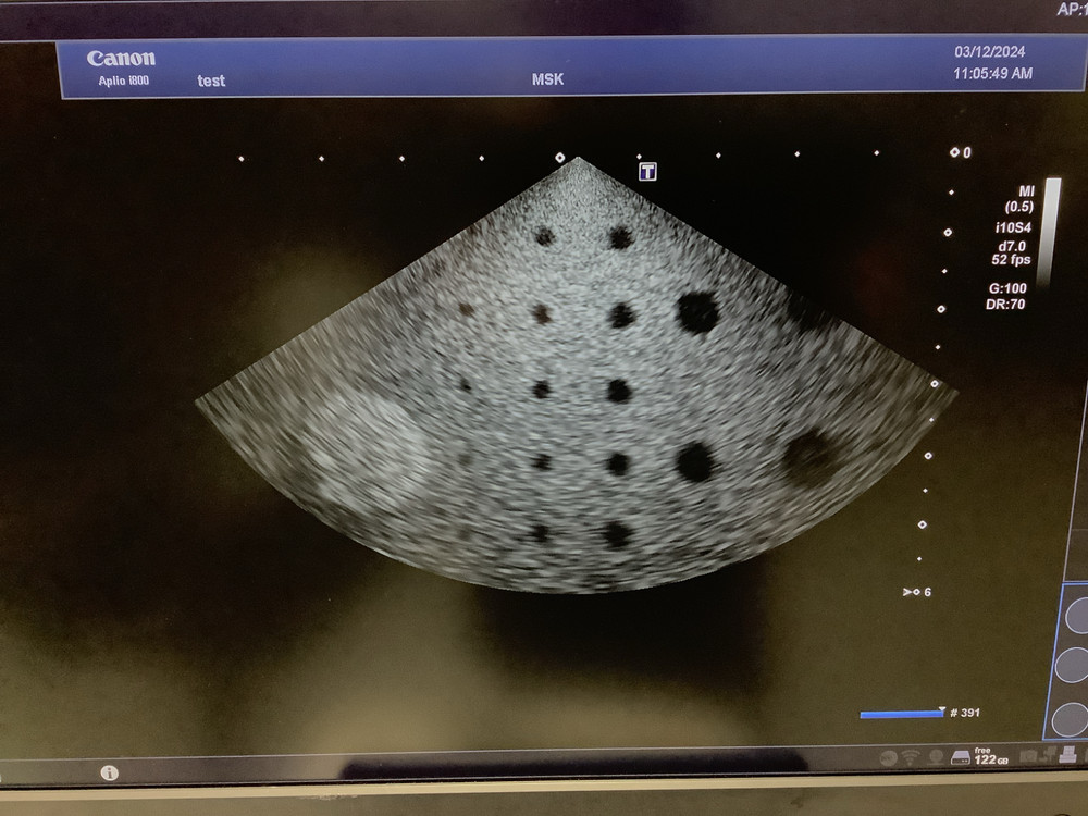 2017 Toshiba PSI-70BT Phased Array Ultrasound Probe