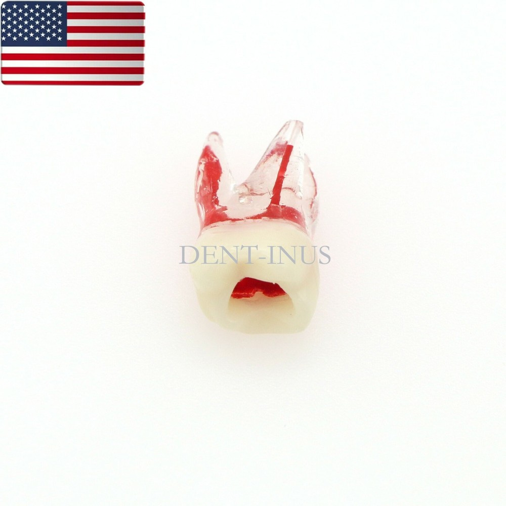 US Dental Endo Molar Root Canal Study Practice Block Pulp Cavity Model RCT/MTA