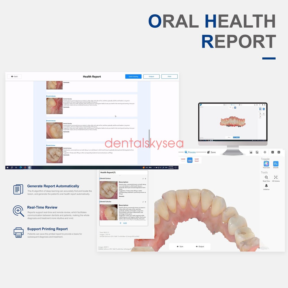 Dental Digital Impression Intraoral 3D Scanner Scanning Software CAD/CAM Process