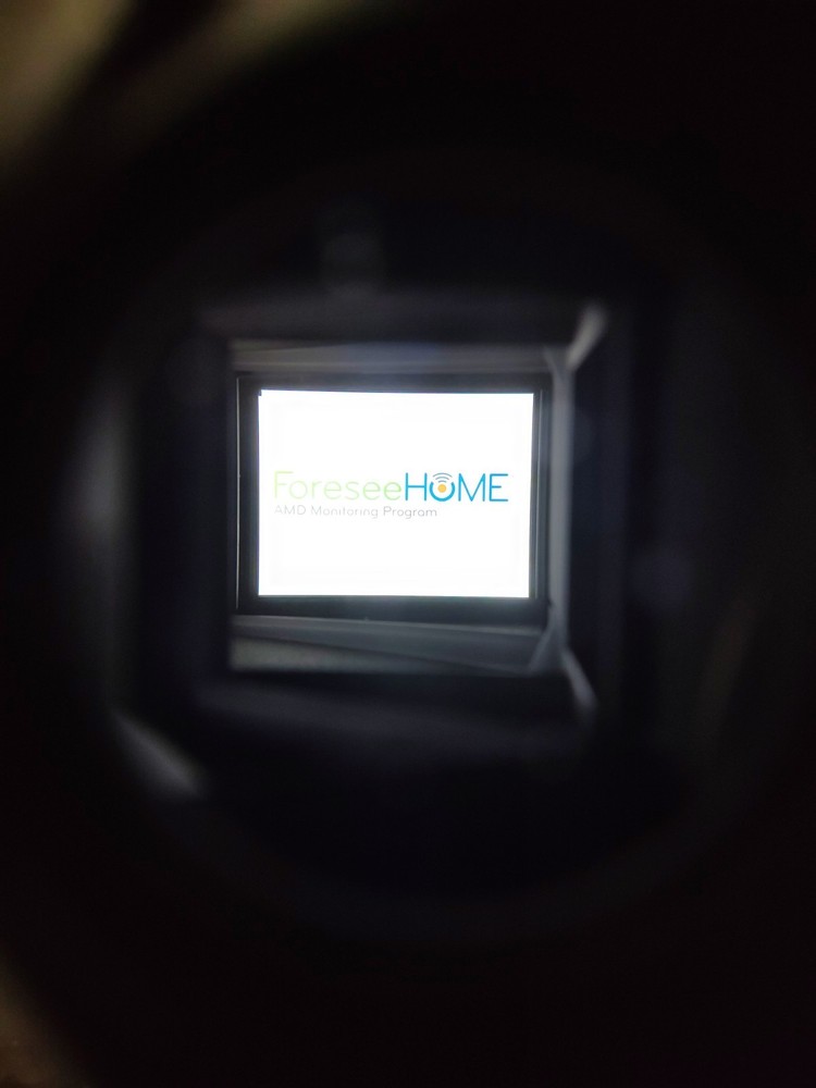 ForeseeHome AMD Monitoring System