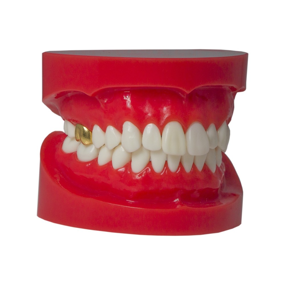 Dental Typodont Teaching Restoration Teeth Model Crown Post Core Bridge M6004
