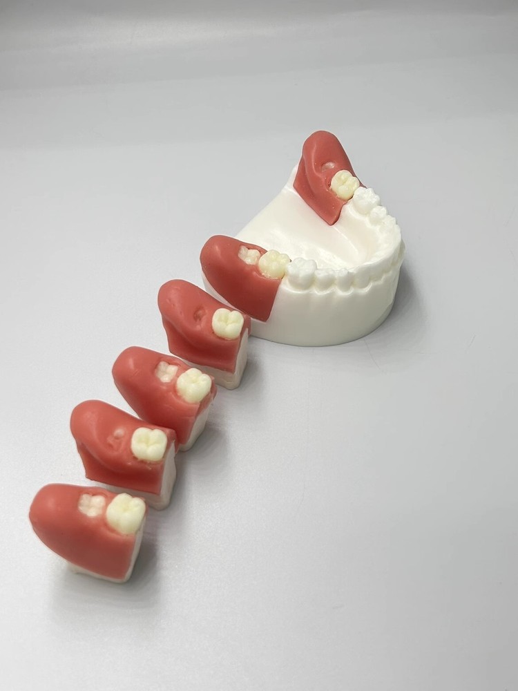 Dental Impacted Tooth Extraction Practice Model Dental Training Display