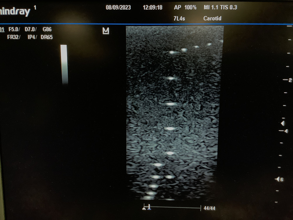 2013 Mindray 7L4s Linear Array Ultrasound Probe