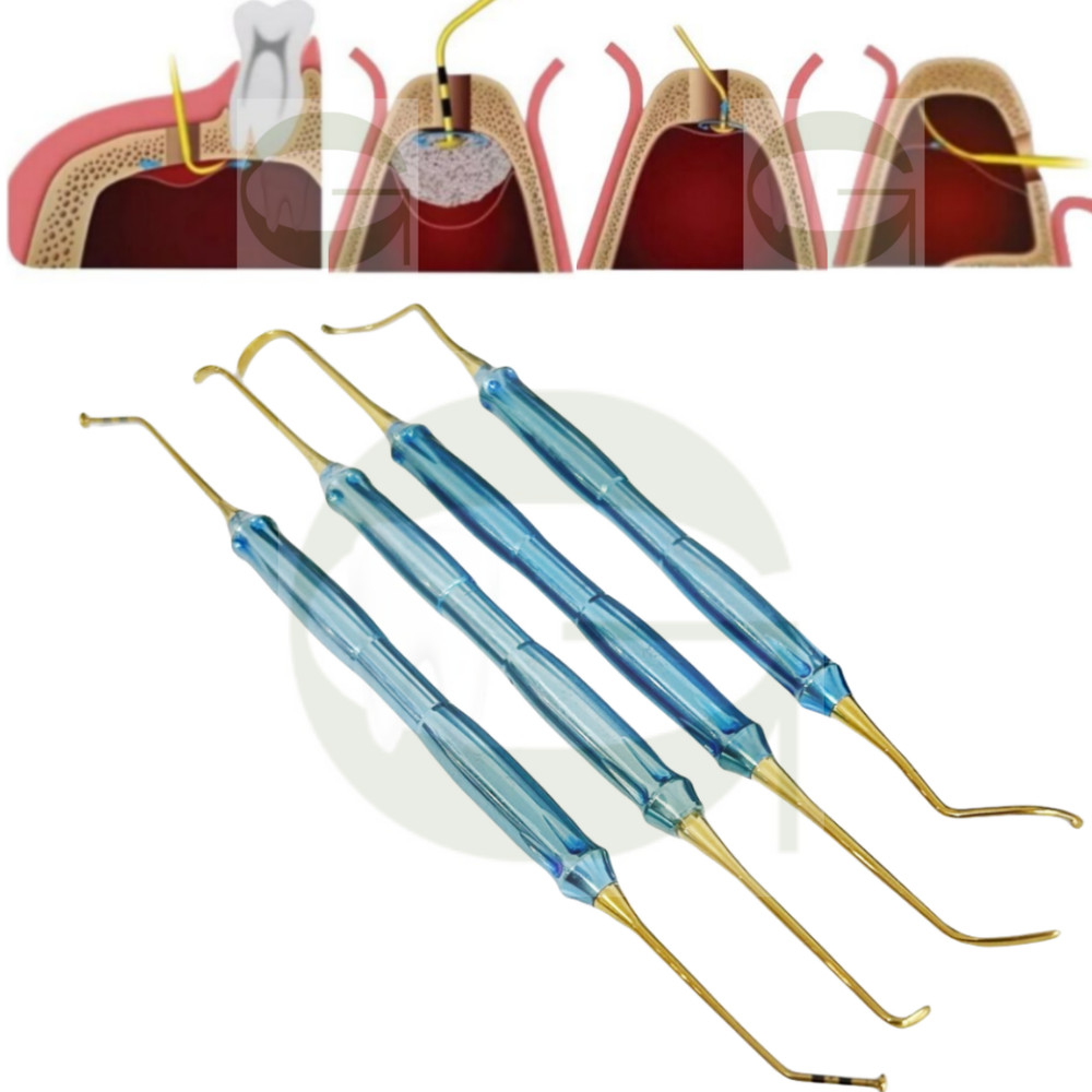 Dental DASK Handle Sinus Lift Membrane Elevator Approach Crestal Lateral Window