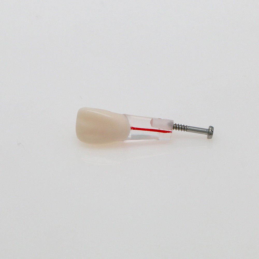 10 Pcs Dental Autoclavable Endo Root Canal Teeth Model Study Practice Typodont
