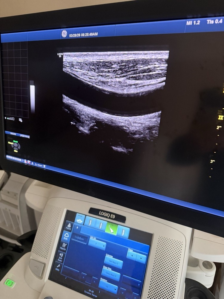 2017 GE 11 L D Probe Excellent working condition