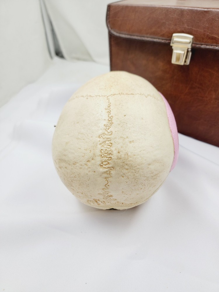 Vintage Somso Anatomical Human Skull And Case